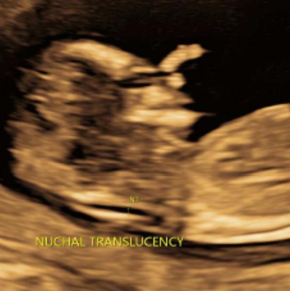 liver health screening rohini