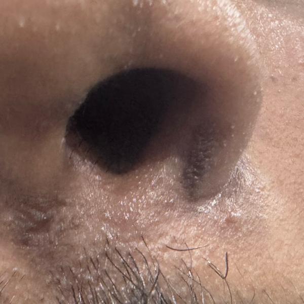 best dermatologist for dandruf