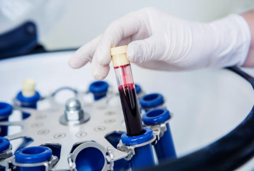 arsenic plasma test delhi