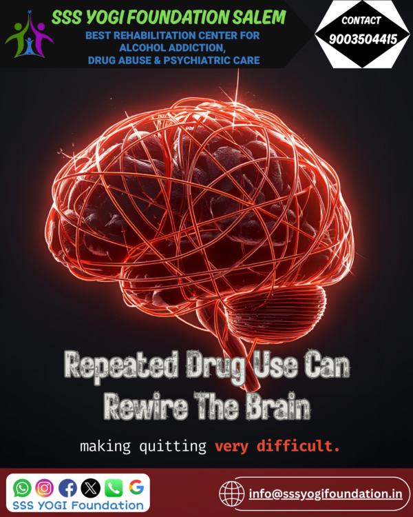 🧠 Repeated Drug Use Can Rewir