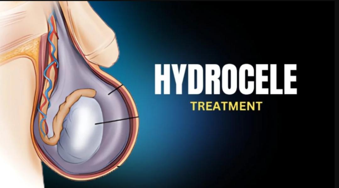 Scrotal swelling can cause dis