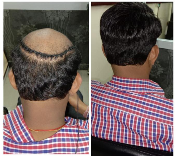 Hair changes can happen for many reasons