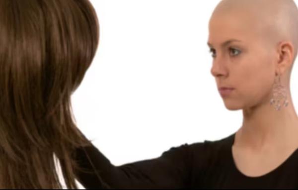 Hair loss during medical treatment can b