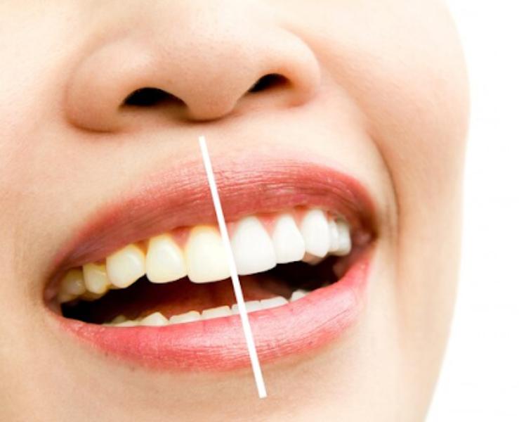 stable long lasting dental imp