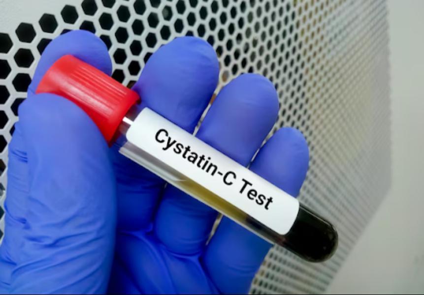 Kidney health is often assesse