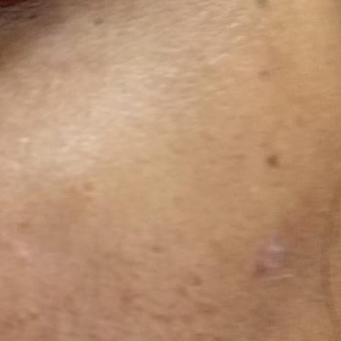 trusted dermatology in thillai