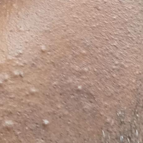 trusted lady dermatology in tr