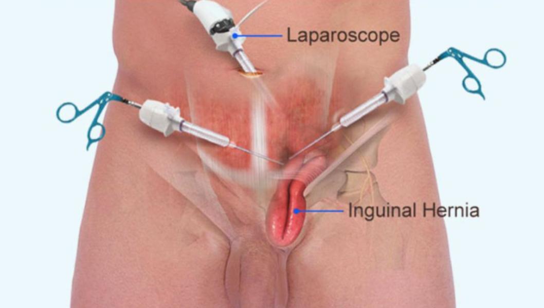 reducing hospital admissions h