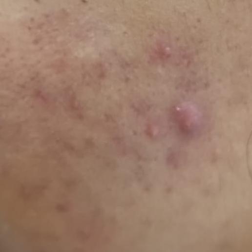 top rated chemical peel center