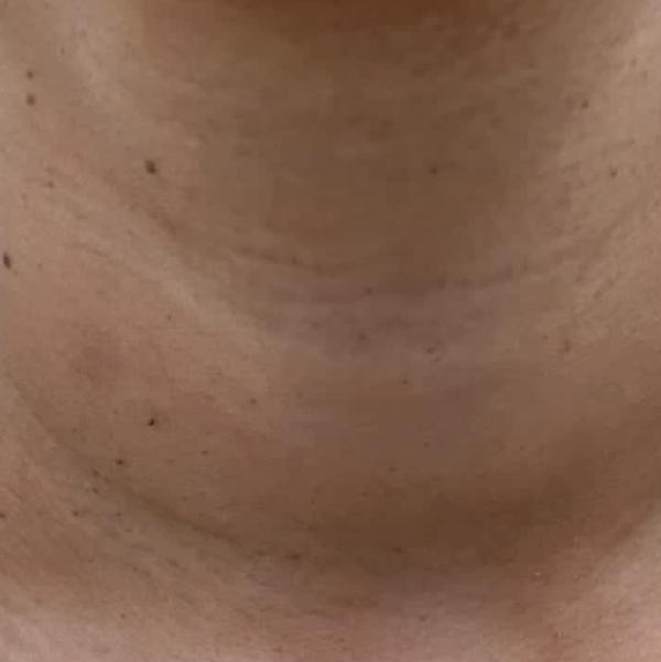 skin rag treatment trichy