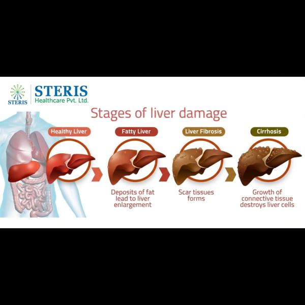 Introduction: Understanding Liver Health The liver