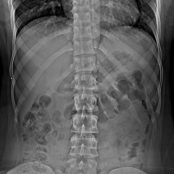 digital x ray services rohini