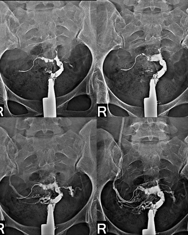 accurate ovulation tracking re