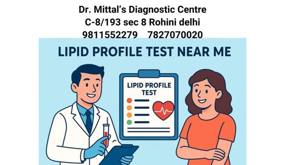 


Lipid profile test in rohin