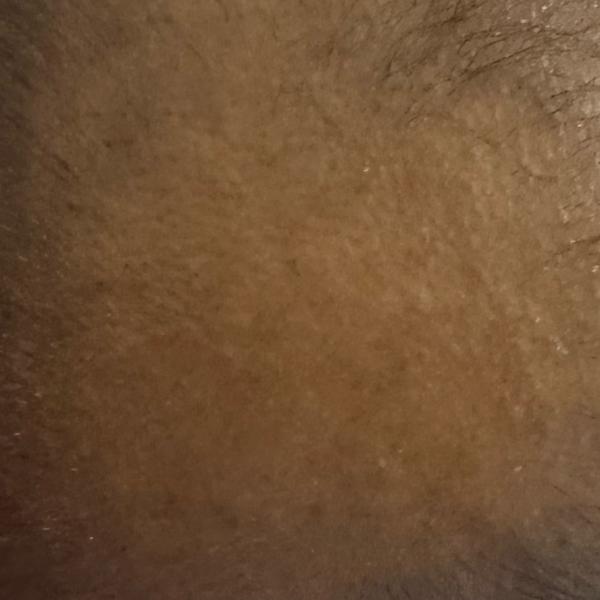 top rated hair treatment cente
