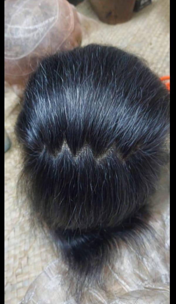 Hair concerns can quietly affect confide