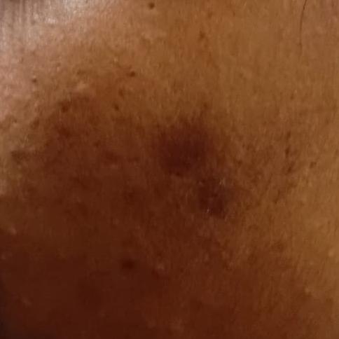best dermatologist for dandruf
