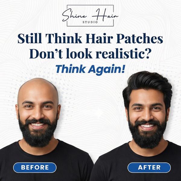 No surgery. No waiting. Just a clean, na