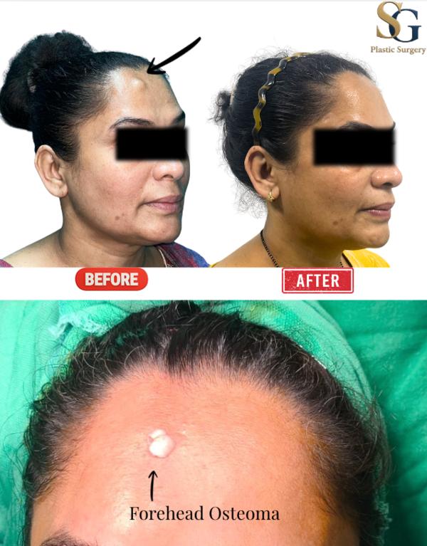 update image
