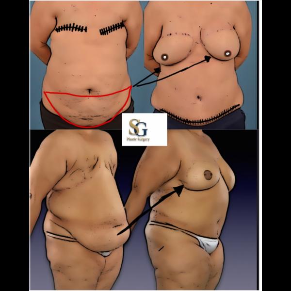 update image