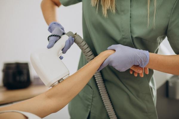 Laser Hair Removal Treatment i