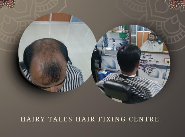 hair replacement centre near me 