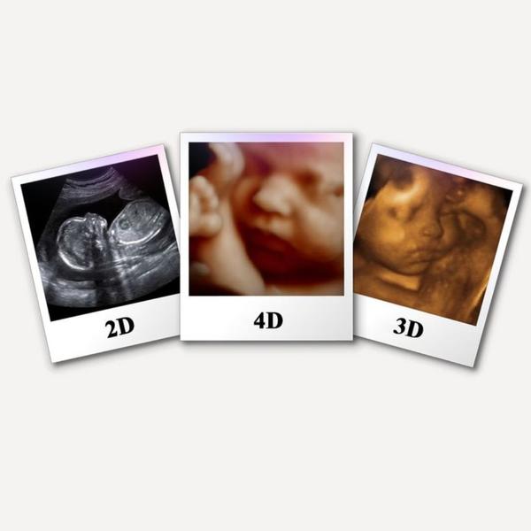 Level 2 Ultrasound (Anomaly Sc