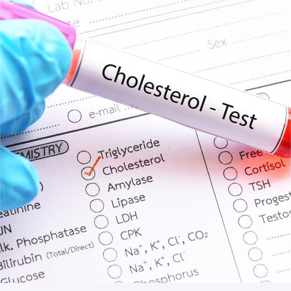 Cholestrol test in rohini delh