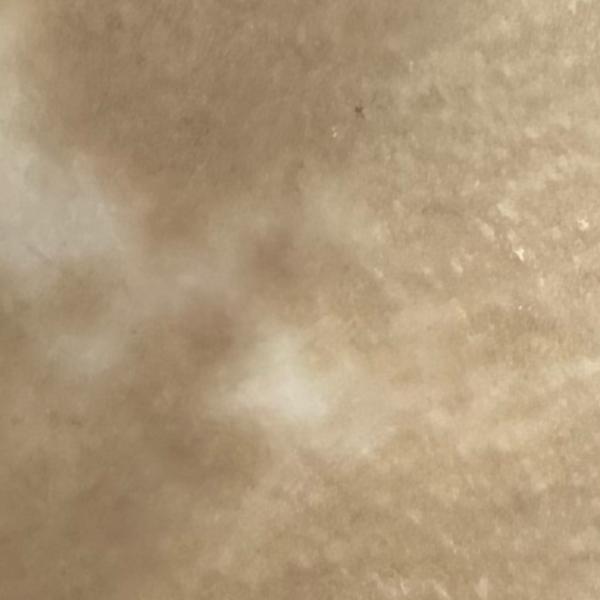 white patches treatment in tri