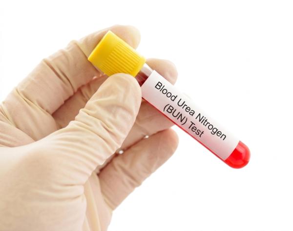 bun levels testing delhi