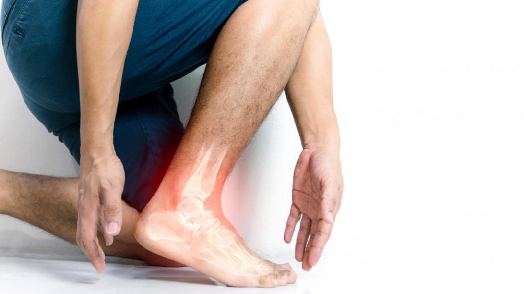 Plantar fasciitis often announ
