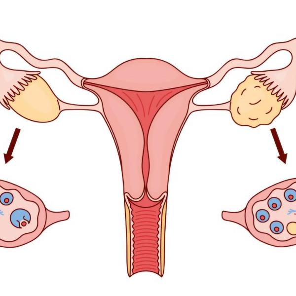 Follicular Study by Female Rad