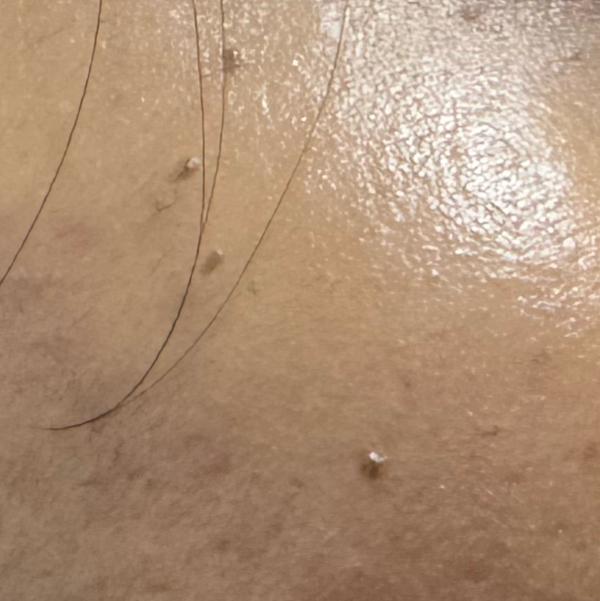 Vibha skin, hair and laser cli