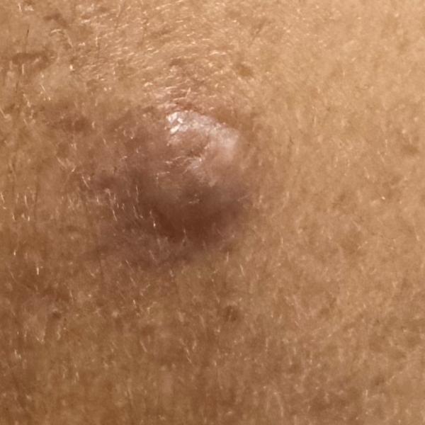 Vibha skin, hair and laser cli