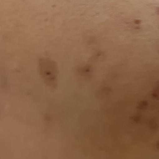 Vibha skin, hair and laser cli