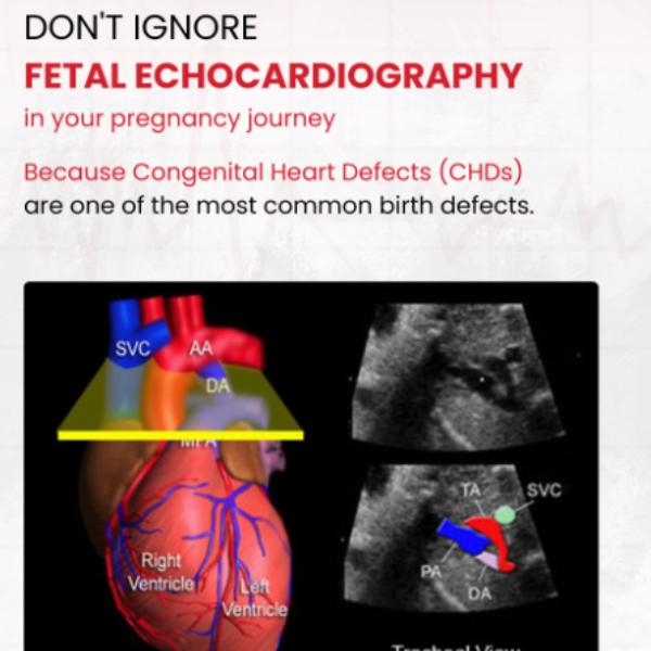 


Fetal echo test in rohini
F