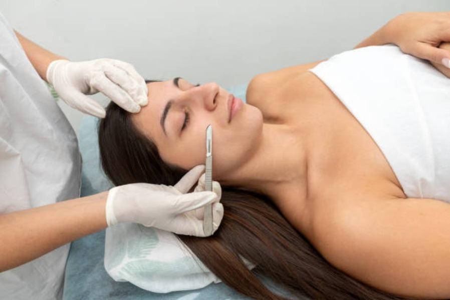 Dermaplaning Treatment in Vers