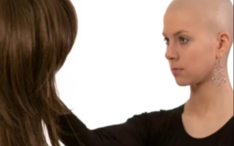 Hair loss due to medical treatment requi