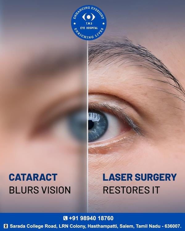 advanced phaco surgery