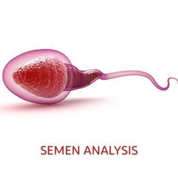 

Semen test in rohini delhi
S