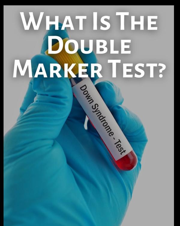 


Dual marker test near me

A