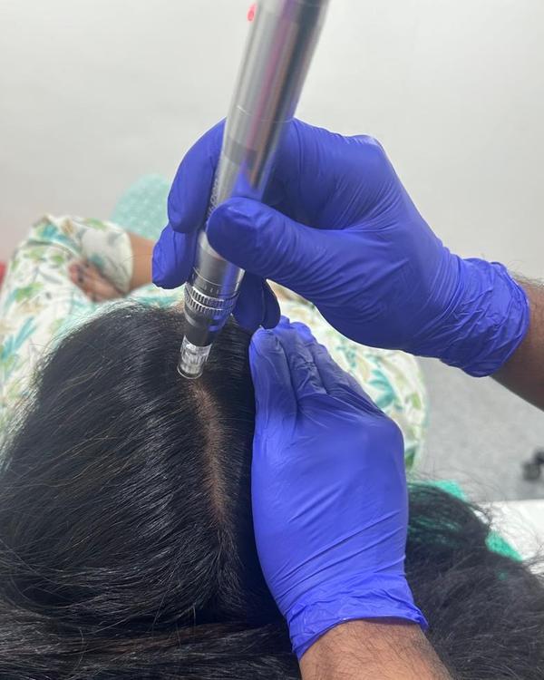 Hair thinning and hair loss ar