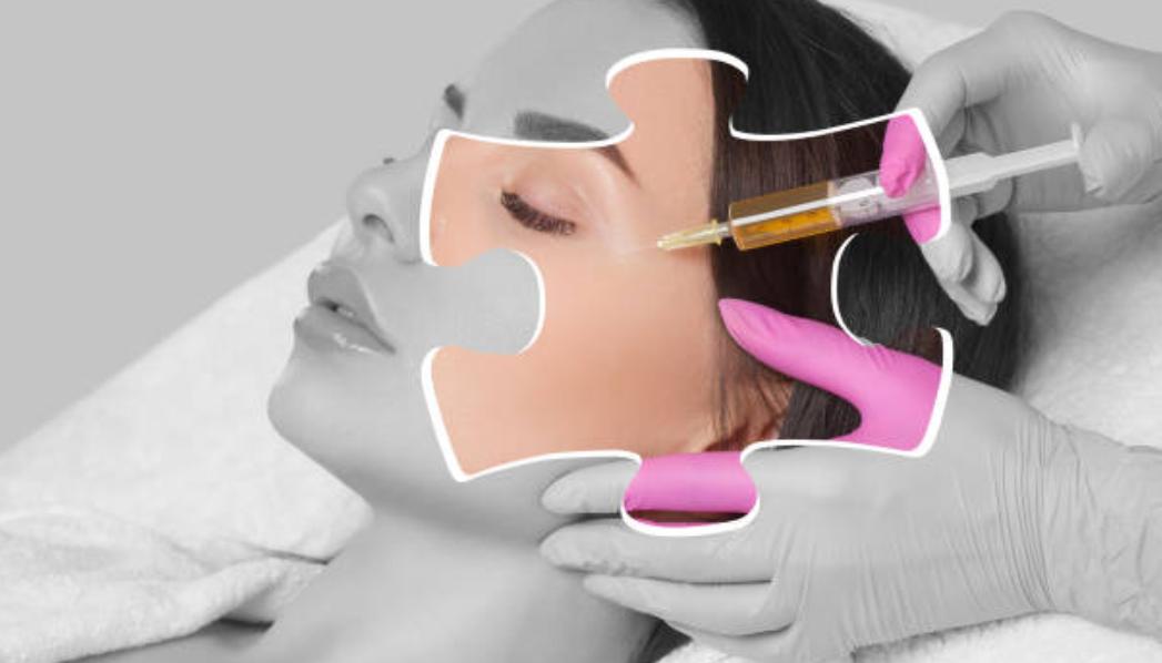 PRP treatments aren’t limited