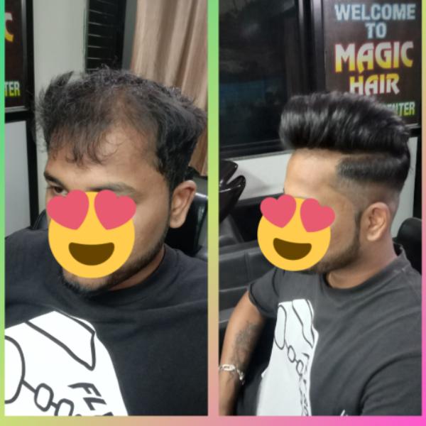 Healthy looking hair plays an important 