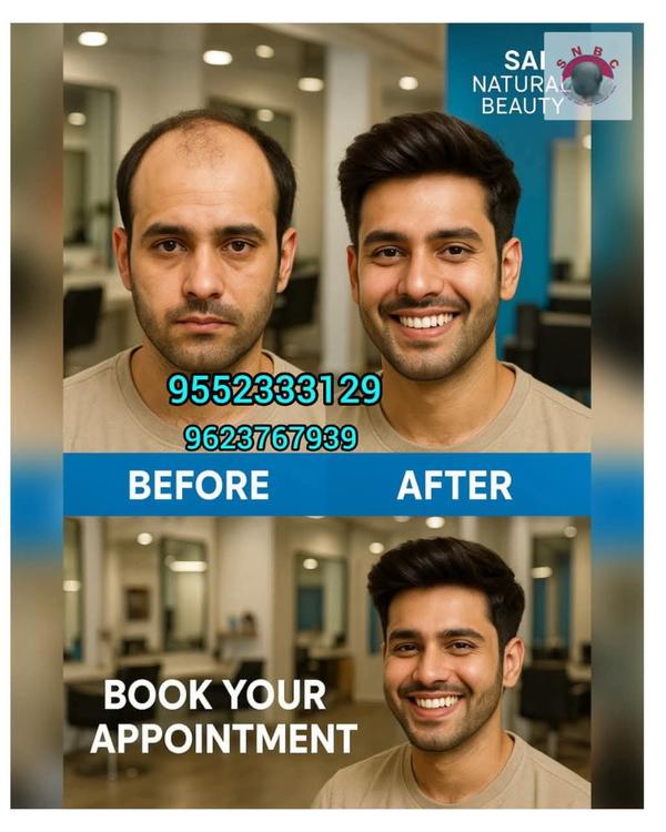 A fuller Head of hair can instantly tran
