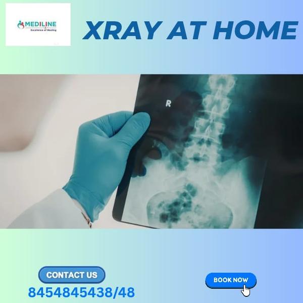 XRAY Servi