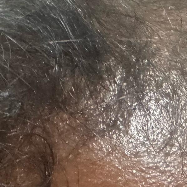 skilled skin doctor near me