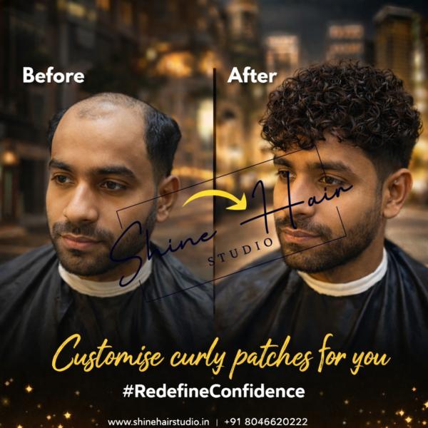 Custom curly patches for you.
Natural lo