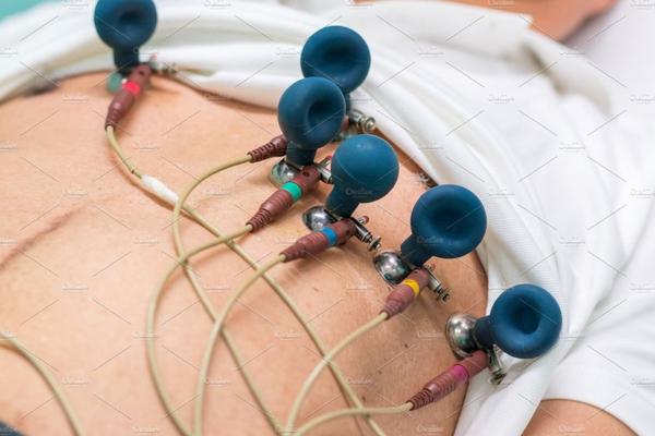 painless ecg procedure