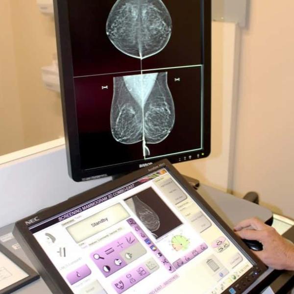 

Mammography Xray near me

C